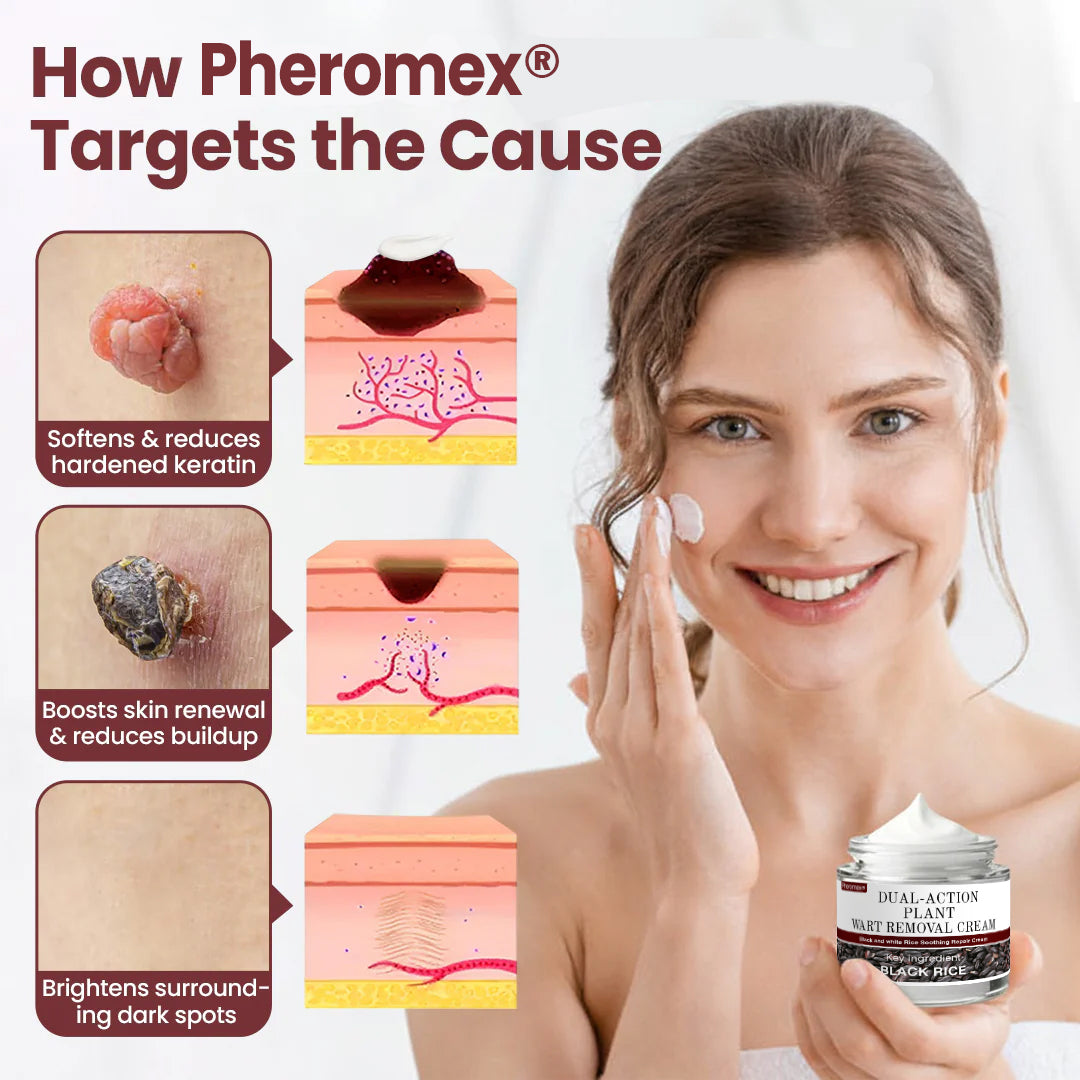 Pheromex®Dual-Action Plant Wart Removal Cream
